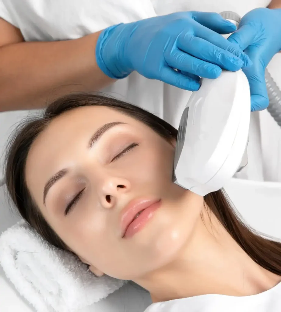 IPL Photorejuvenation