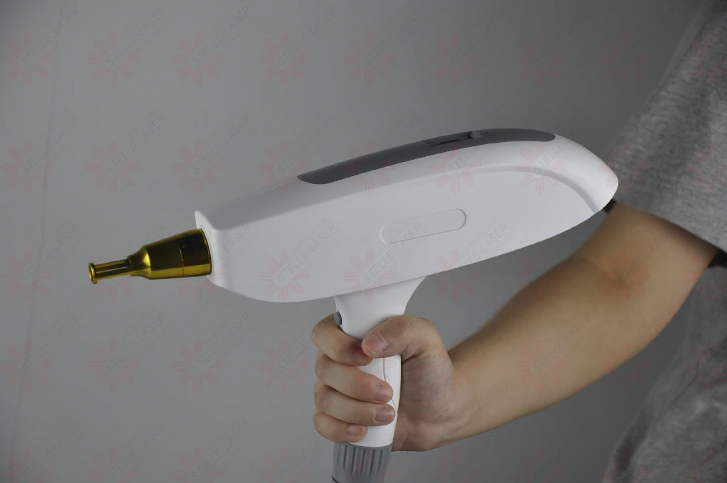 ndyag laser tattoo removal
